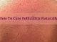 15 Natural Home Remedies for Folliculitis Cure – Signs, Symptoms & Treatment Home Remedies for Folliculitis Cure