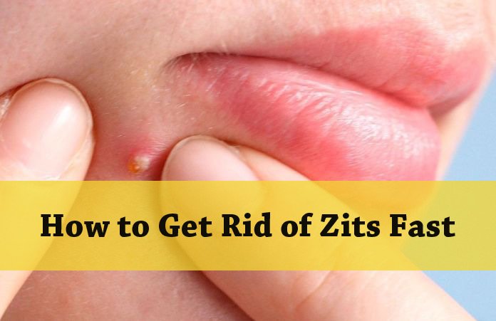 What gets rid of zits fast
