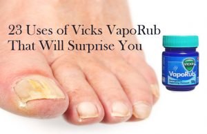 23 Uses of Vicks VapoRub That Will Surprise You – Treating From Head To Toe Nails Uses of Vicks VapoRub That Will Surprise You