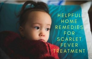 10 Most Helpful Home Remedies For Scarlet Fever Treatment Helpful Home Remedies For Scarlet Fever Treatment
