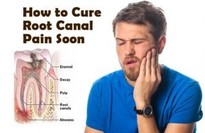15 Easy Home Remedies To Cure Root Canal Pain Fast That Work Easy Home Remedies To Cure Root Canal Pain Fast