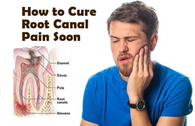 Easy Home Remedies To Cure Root Canal Pain Fast