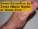 15 Effective Home Remedies to Treat Minor Burns at Home Fast Home Remedies to Treat Minor Burns at Home Fast