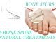 15 Bone Spurs (Neck And Knee) Natural Treatments That Work Bone Spurs (Neck And Knee) Natural Treatments