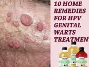 Natural Ways To Get Rid Of Warts On Dogs Natural Ways To Get Rid Of Warts On Dogs