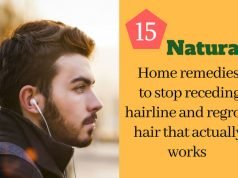 How To Get Rid Of Receding Hairline Naturally How To Get Rid Of Receding Hairline Naturally