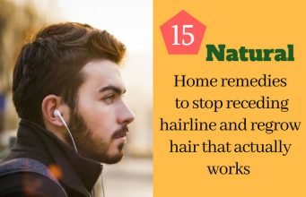 15 Home Remedies to Stop Receding Hairline and Regrow Hair that Actually Works Home remedies to stop receding hairline and regrow hair