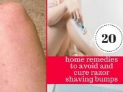 20 Quick and Easy Home Remedies to Get Rid of Razor Bumps and Burns Fast